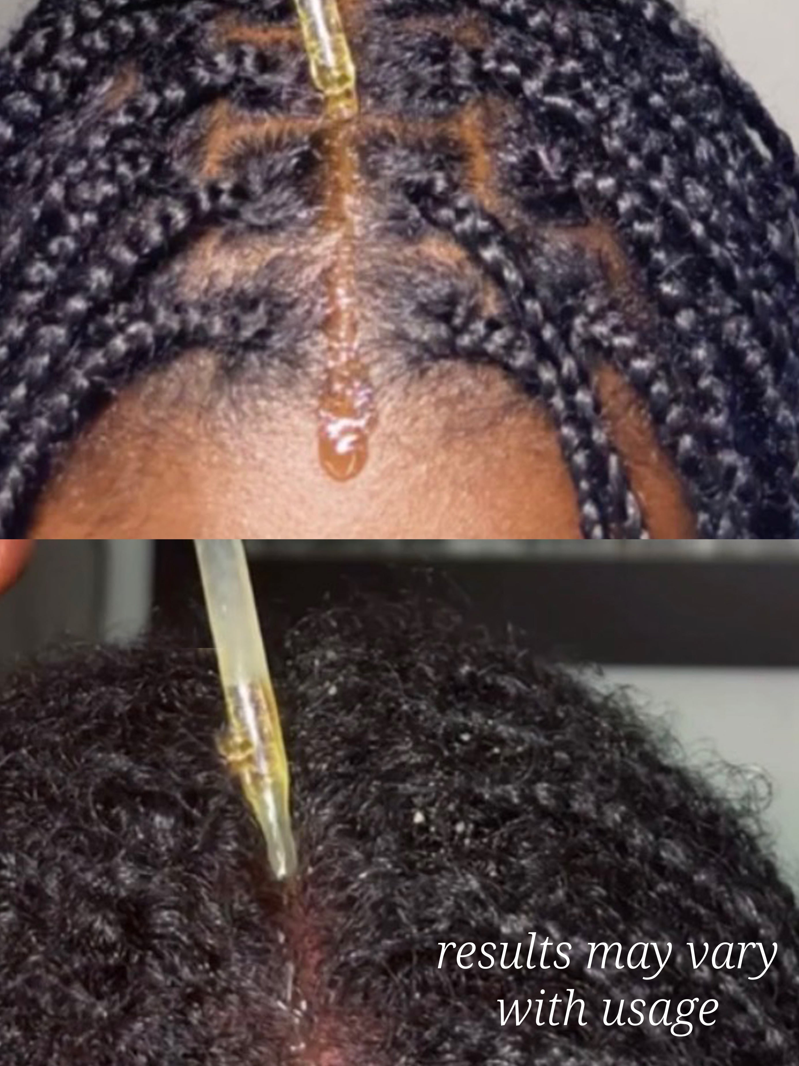 Extra Strength Herbal Growth Oil